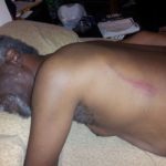 Lester Chambers' injuries following the assault, posted by his son Dylan